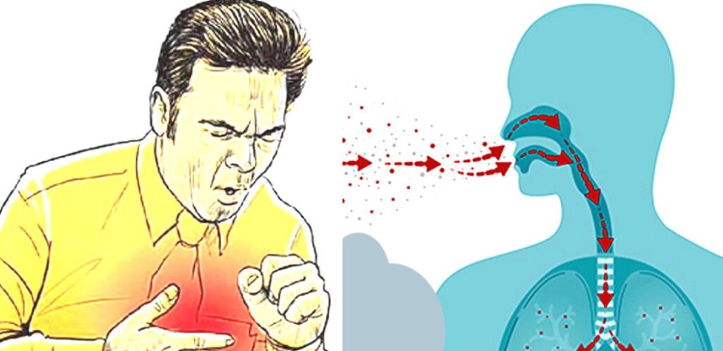 विश्वभर १ करोड ७ लाख सक्रिय क्षयरोगी, नेपालका ४२ प्रतिशत उपचार बाहिर
